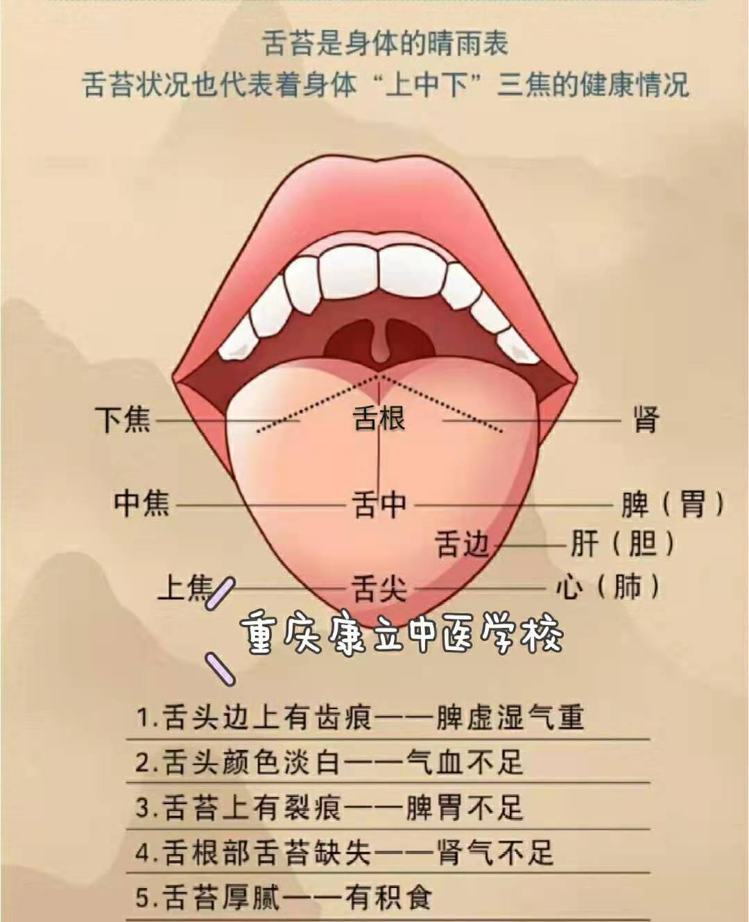 舌苔位置图片
